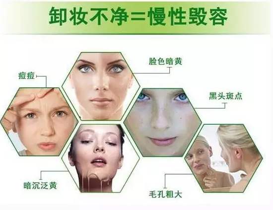 爱视力药业眼贴适宜人群卸妆不净
