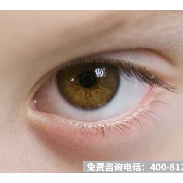 简简单单9件事，眼睛远离近视于与干涩