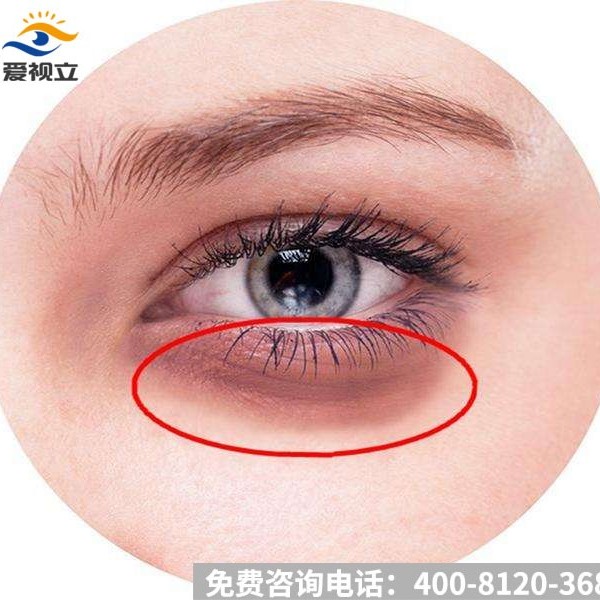 爱视力中草药护眼霜、护眼贴
